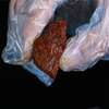 중국 산동성 HDPE CPE 일회용 PE 장갑 수출